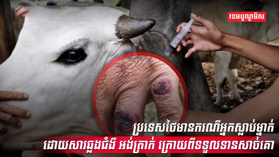 ជំងឺ អង់ត្រាក់