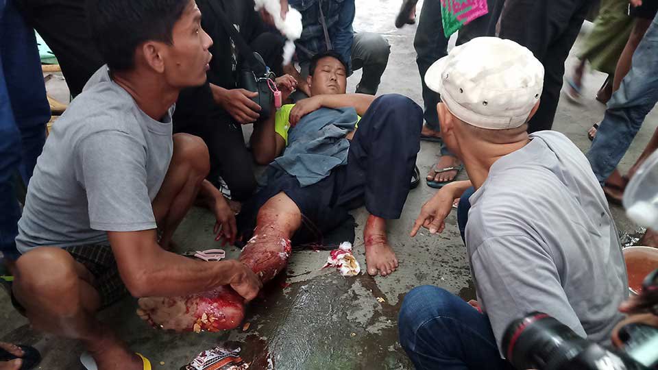 រូបភាពបុរស​ត្រូវគេបាញ់​ឲ្យ​រងរបួស​ នៅក្នុងការបង្ក្រាប​បាតុកម្ម​ ថ្ងៃទី២៨ កុម្ភៈ ឆ្នាំ​២០២១ នៅ​ប្រទេស​មីយ៉ាន់ម៉ា ។ រូបភាពពី Twitter: Myanmar Now